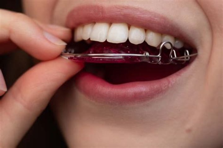 Can my retainer make me sick