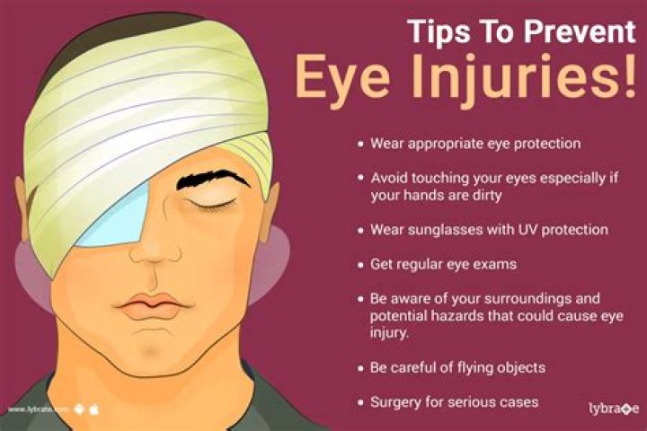 What Happened To Israel Gutierrez Eye Injury And Face? NBA Reporter Wearing A Band-Aid Explained